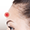 forehead-depression