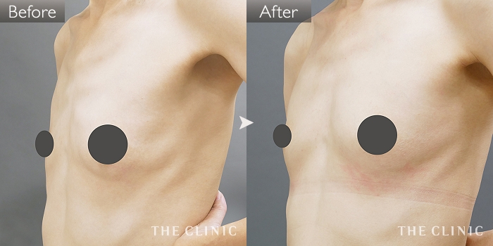 Rsbmwg1ox0fozm Rsbmwg1ox0fozm